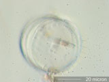 Diatom, Stephanodiscus